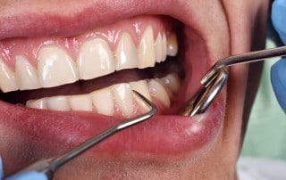 Dentist inspecting a patient gums