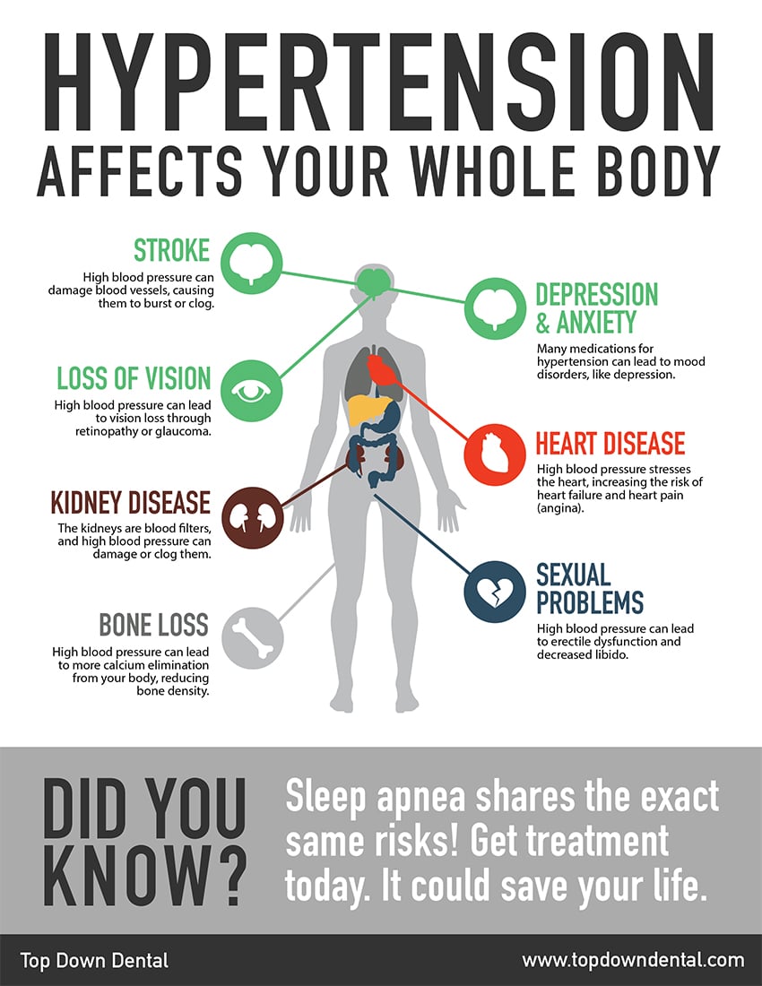 Top Down Dental sleep apnea infographic