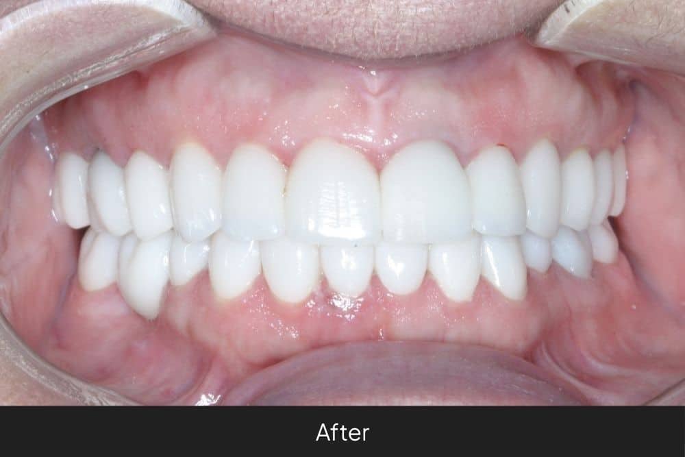 Veronica’s Journey To Pain Relief And A Confident Smile