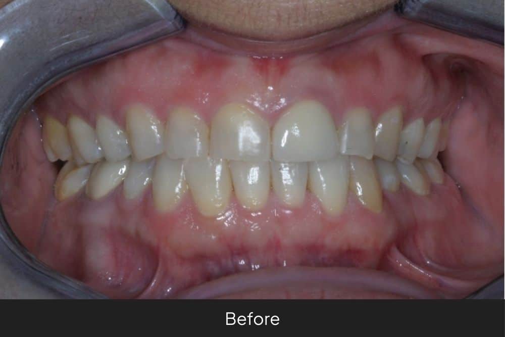 Veronica’s Journey To Pain Relief And A Confident Smile